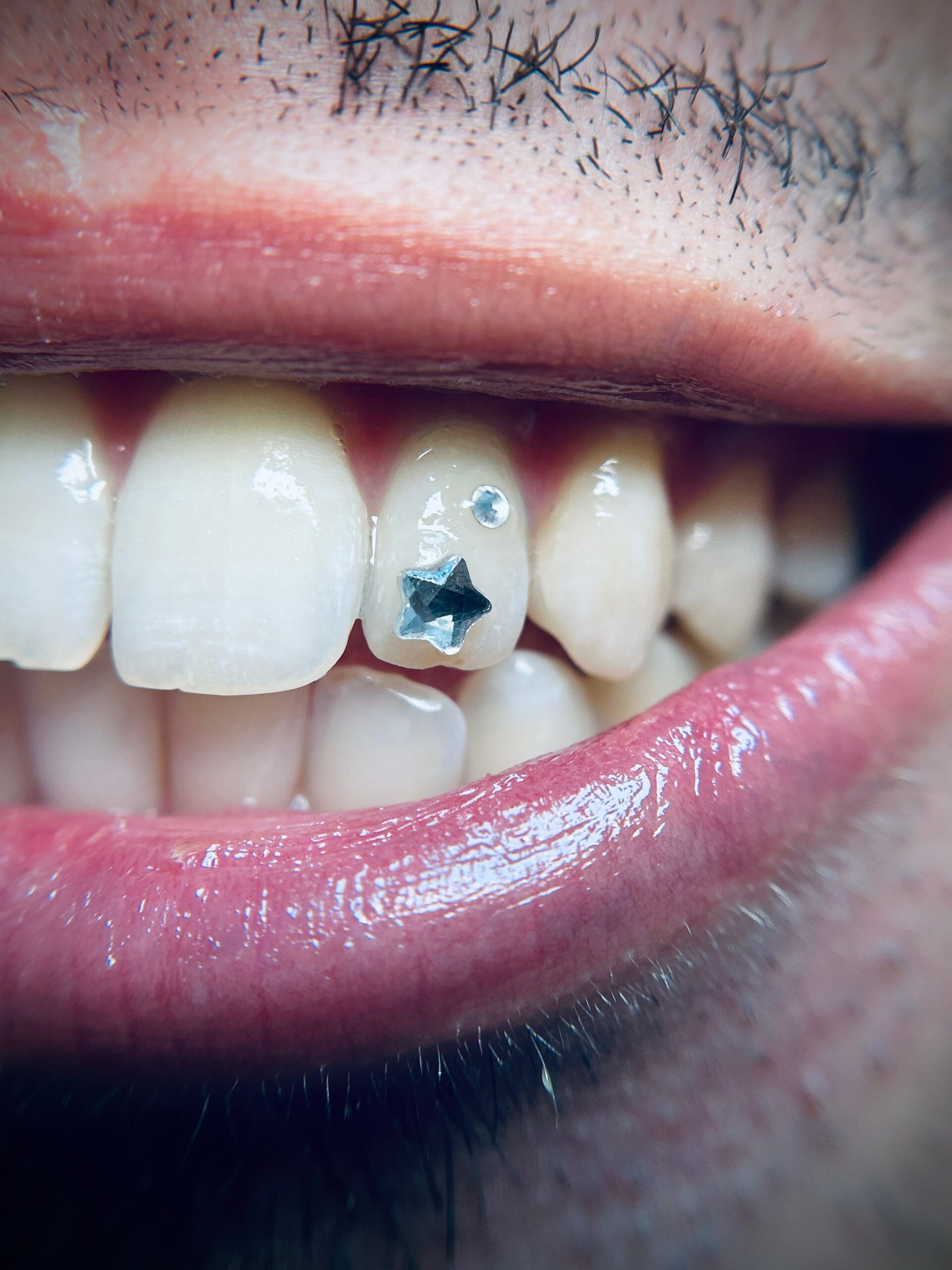 Resultado gema dental pack exclusivo