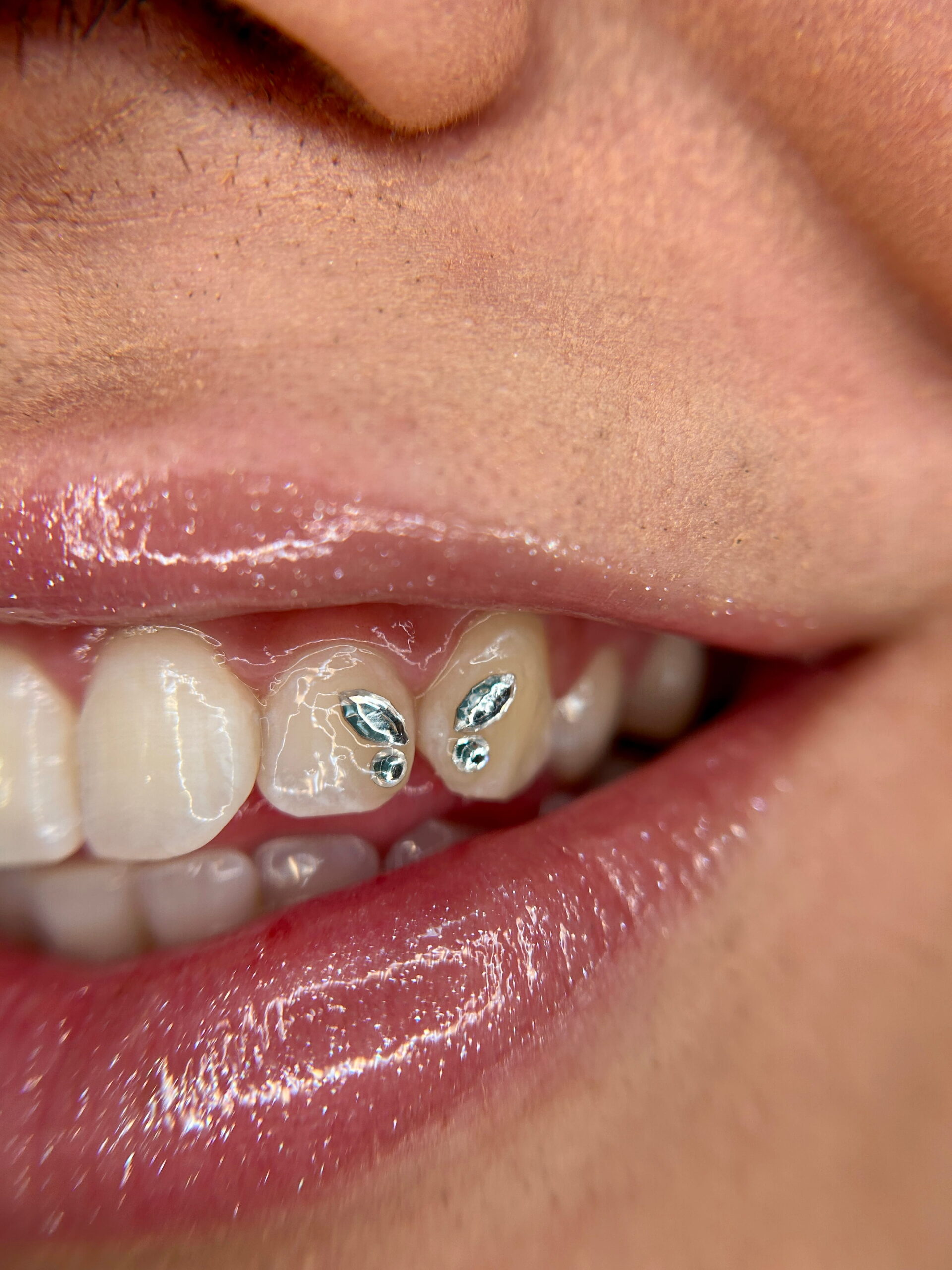 Resultado gema dental gold premium